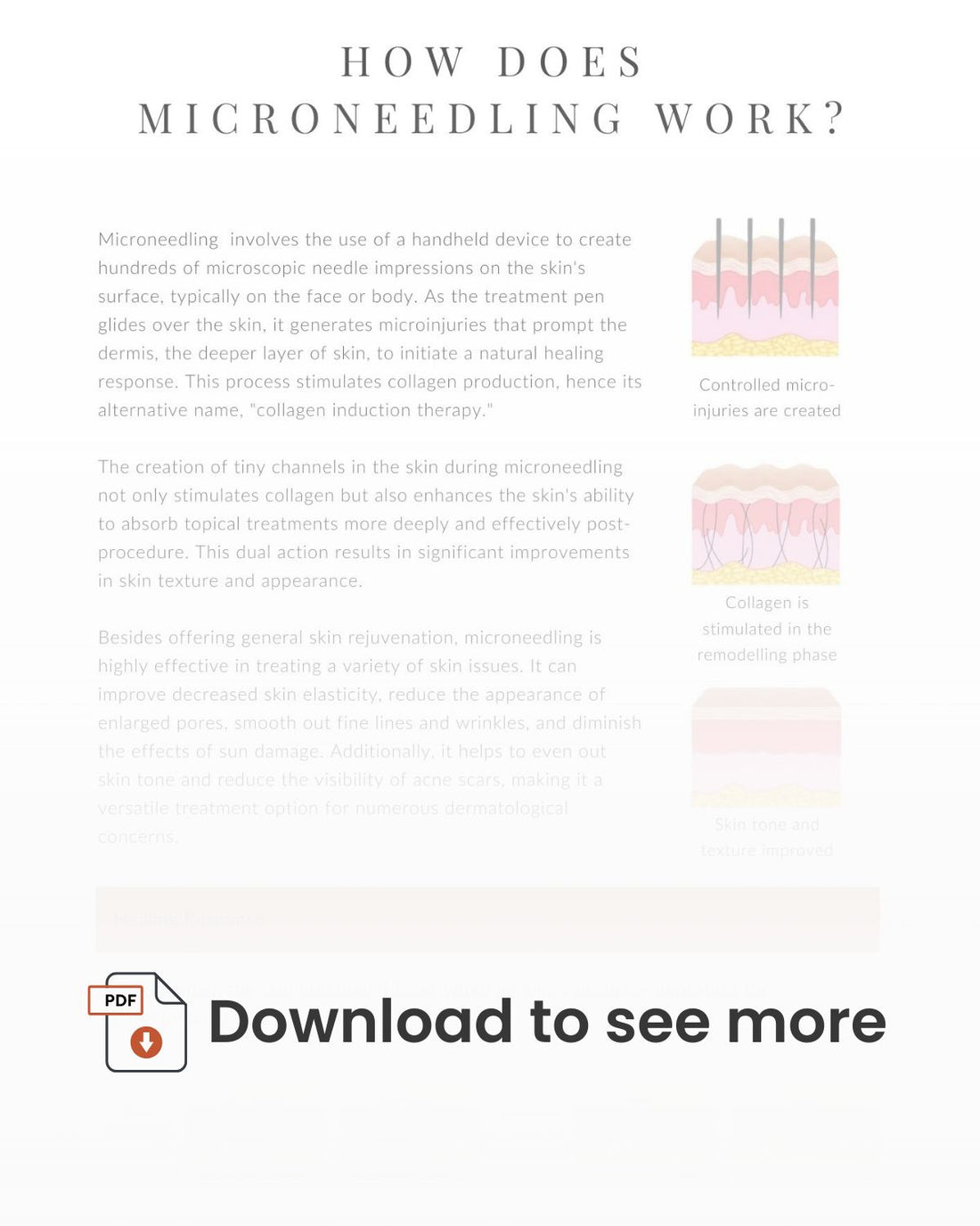 E-book Microneedling